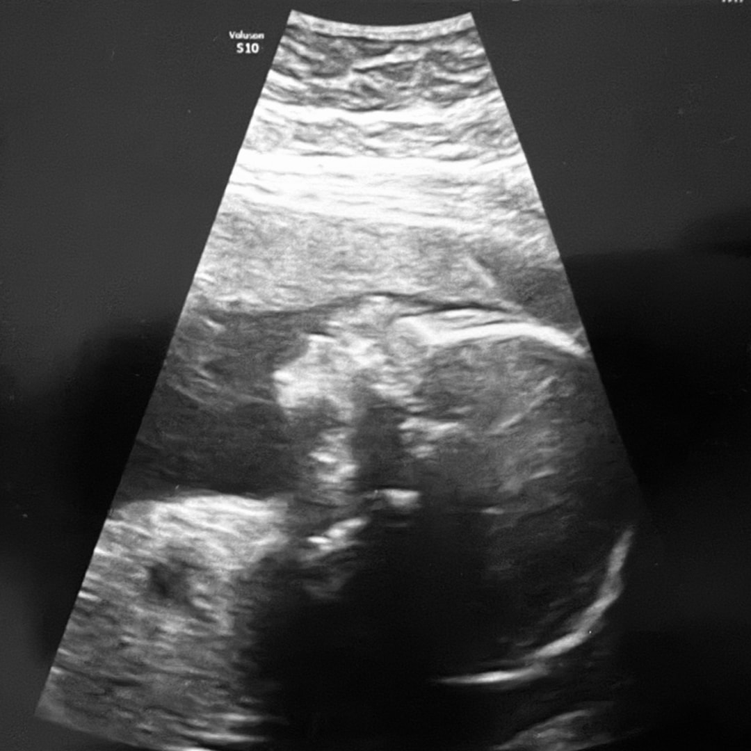 Photo shared by Nicole for their Babylist baby registry.
