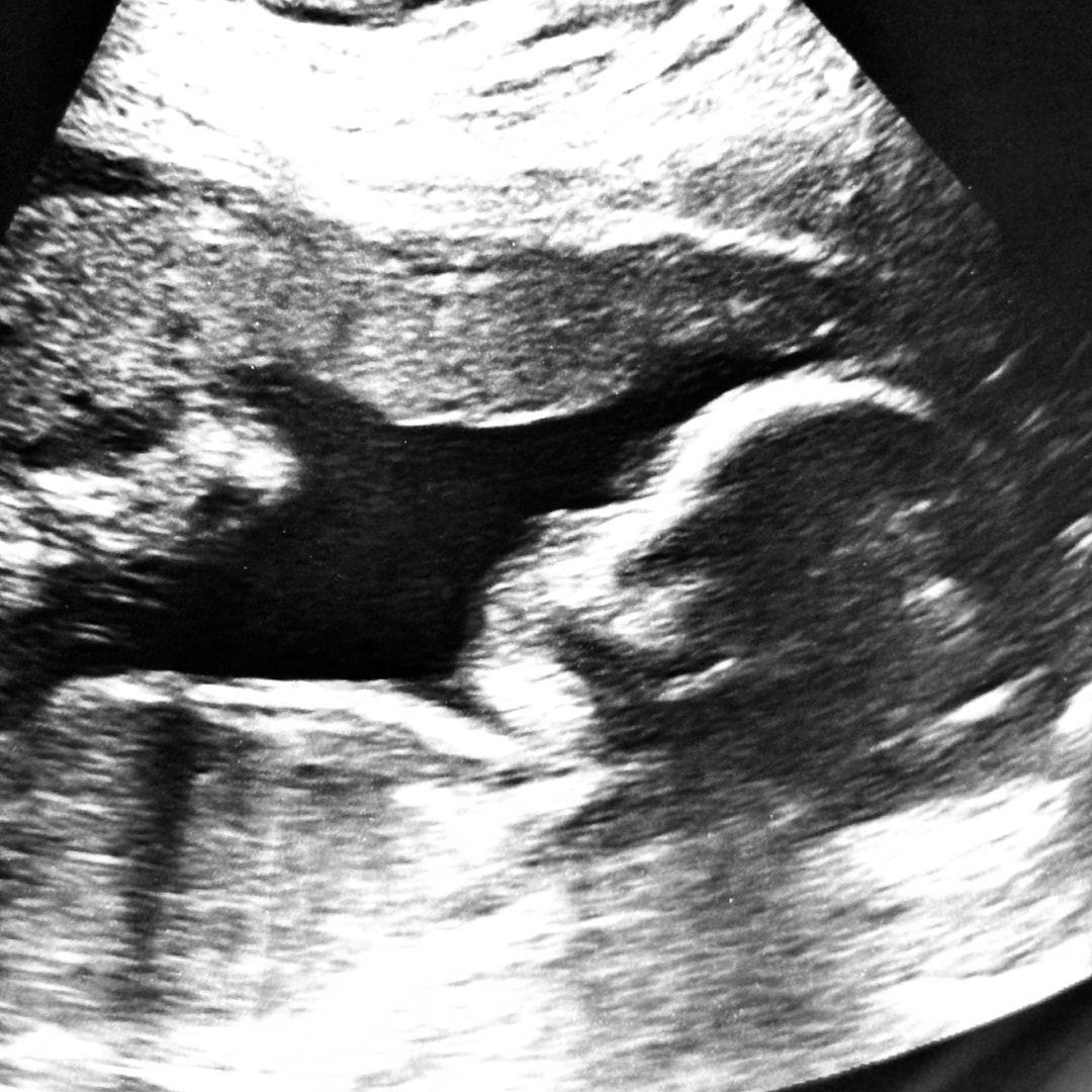 Photo shared by Diana for their Babylist baby registry.