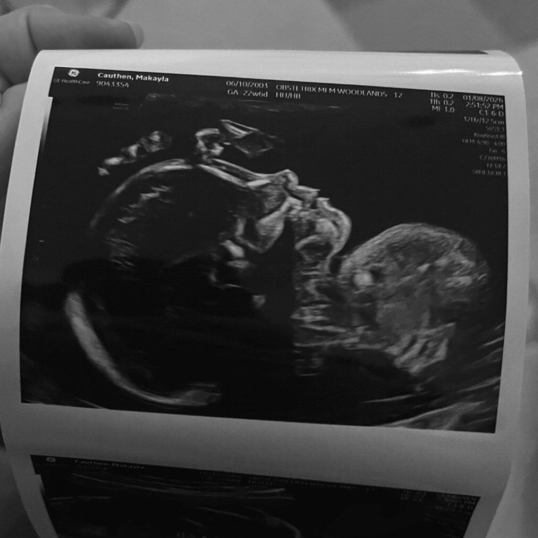 Photo shared by Makayla for their Babylist baby registry.