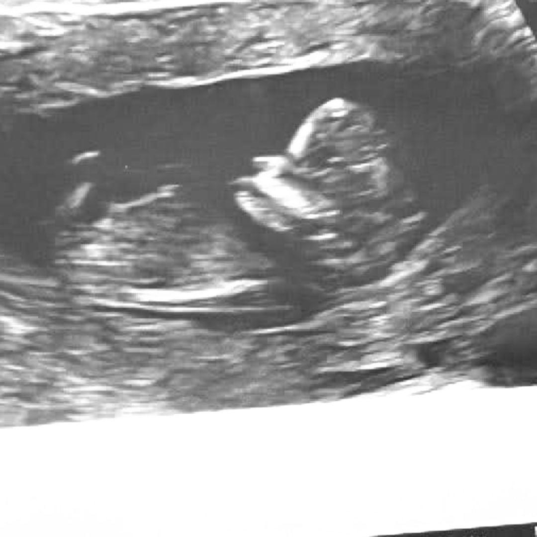 Photo shared by Destiny for their Babylist baby registry.