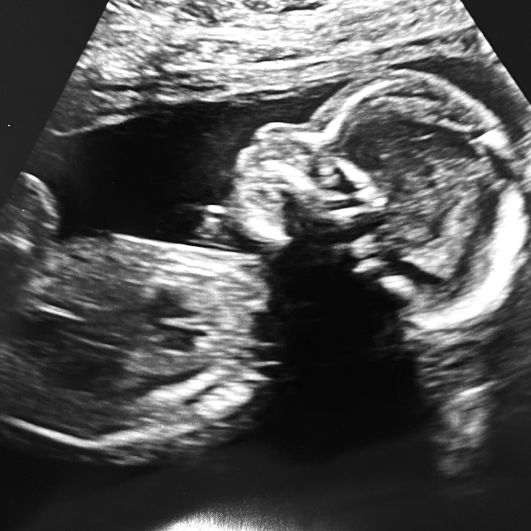 Photo shared by Mackenzie for their Babylist baby registry.