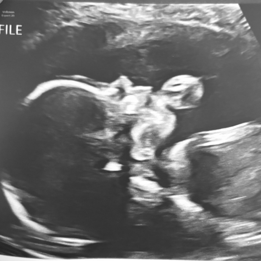 Photo shared by Courtney for their Babylist baby registry.