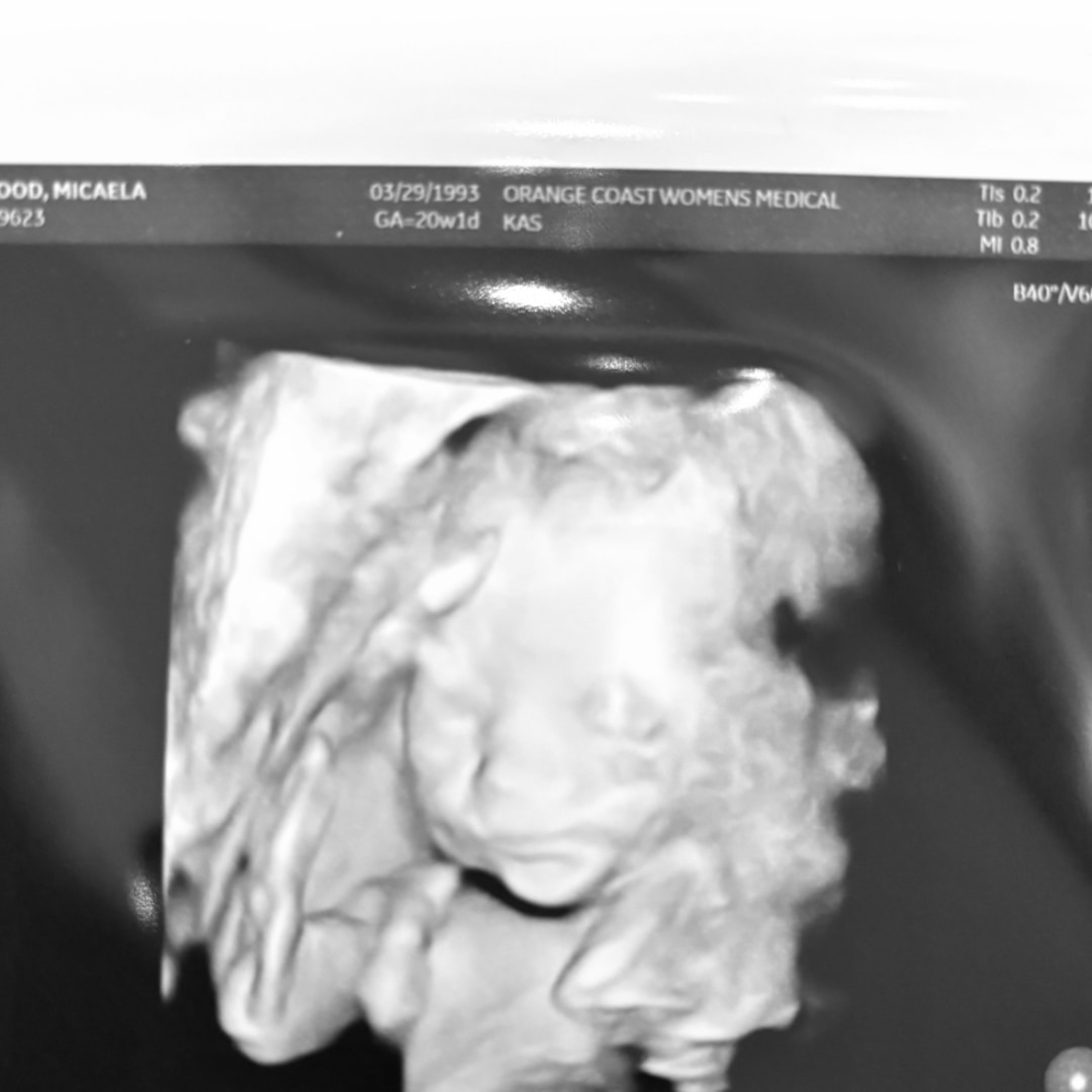 Photo shared by Micaela for their Babylist baby registry.