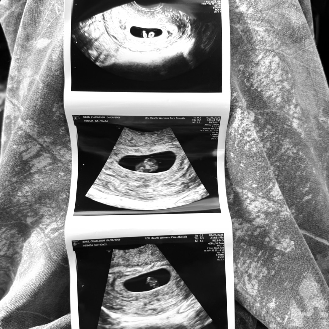 Photo shared by Charleigh for their Babylist baby registry.