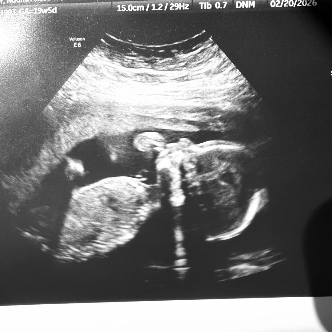 Photo shared by Naomi for their Babylist baby registry.