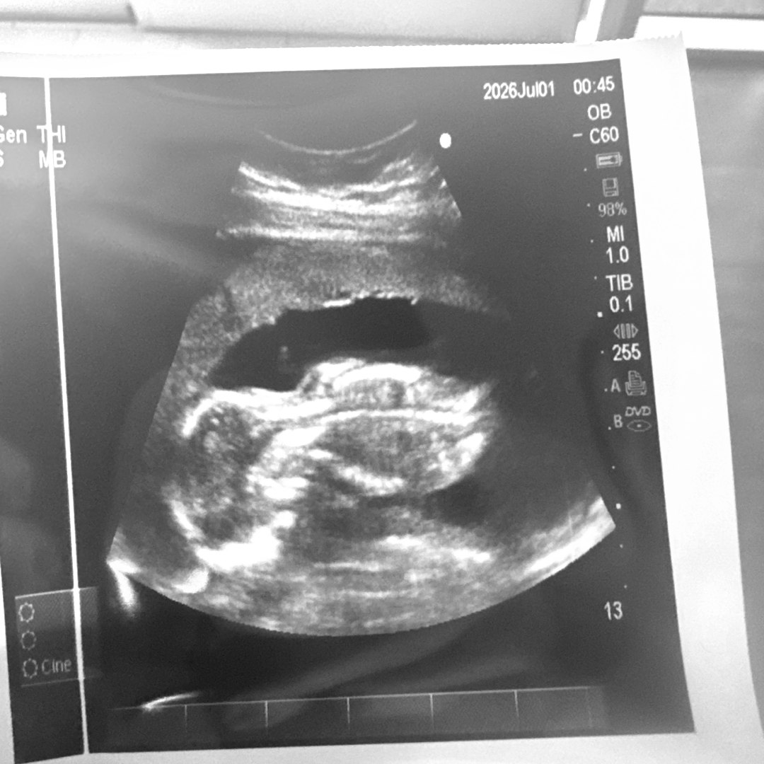 Photo shared by Alli for their Babylist baby registry.