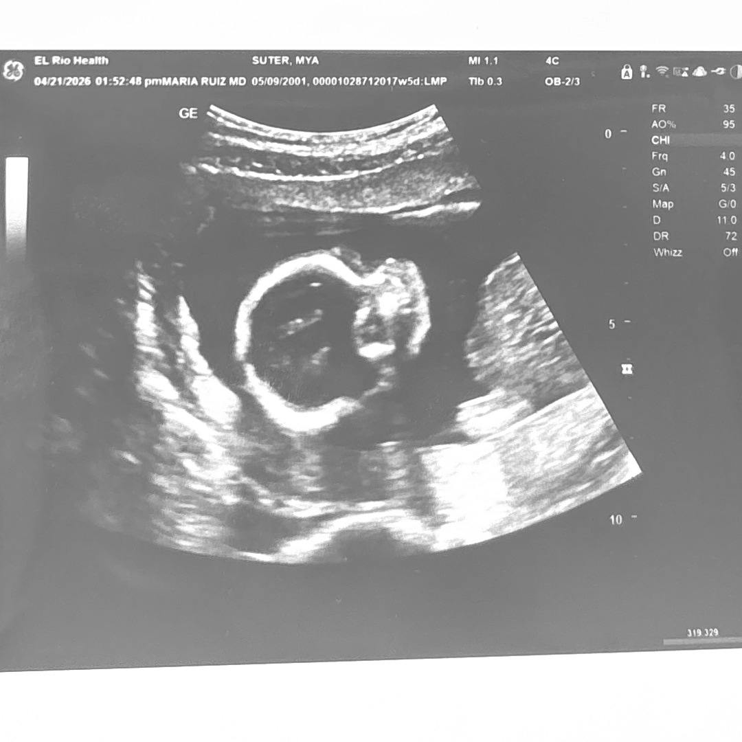 Photo shared by Mya for their Babylist baby registry.