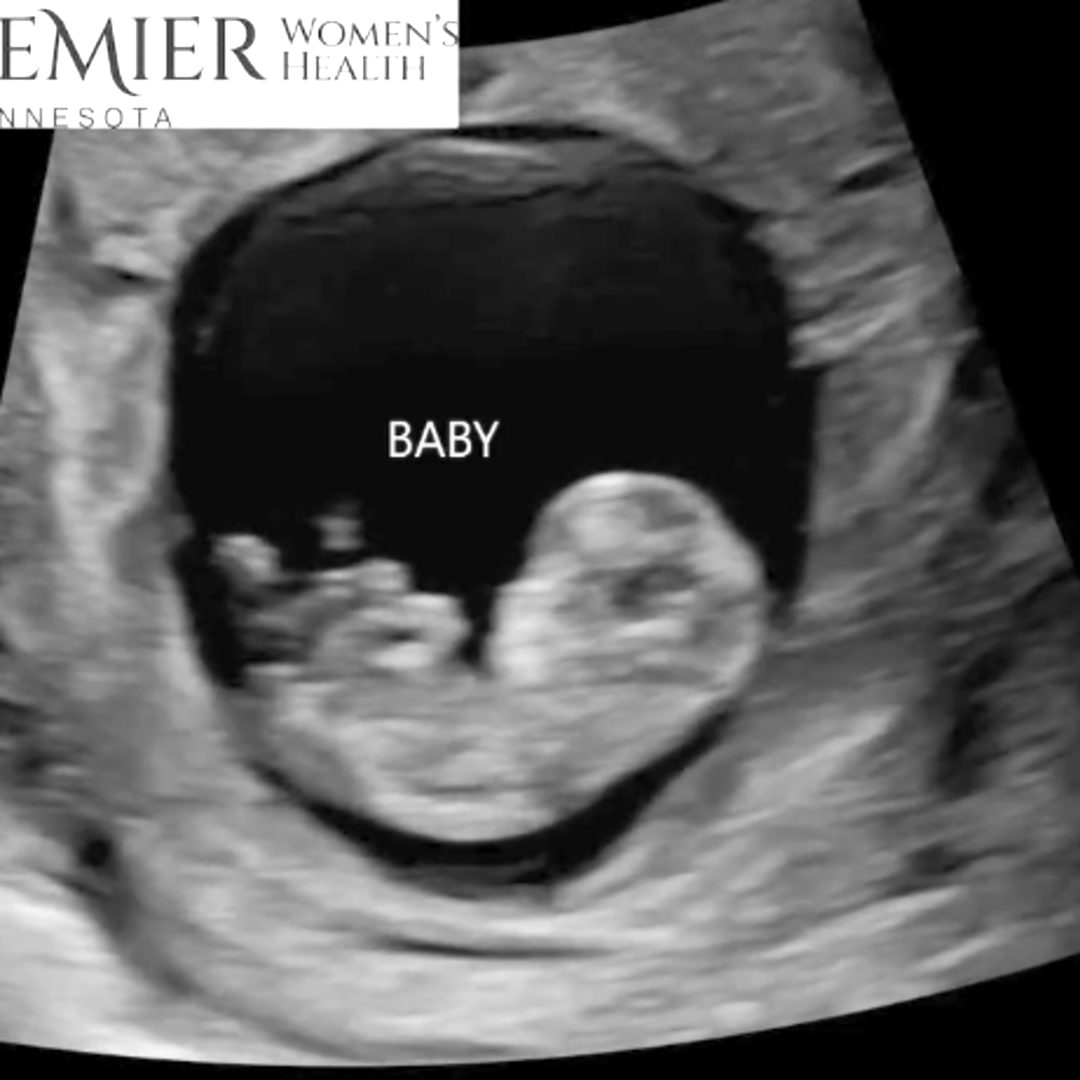 Photo shared by Brajnay for their Babylist baby registry.