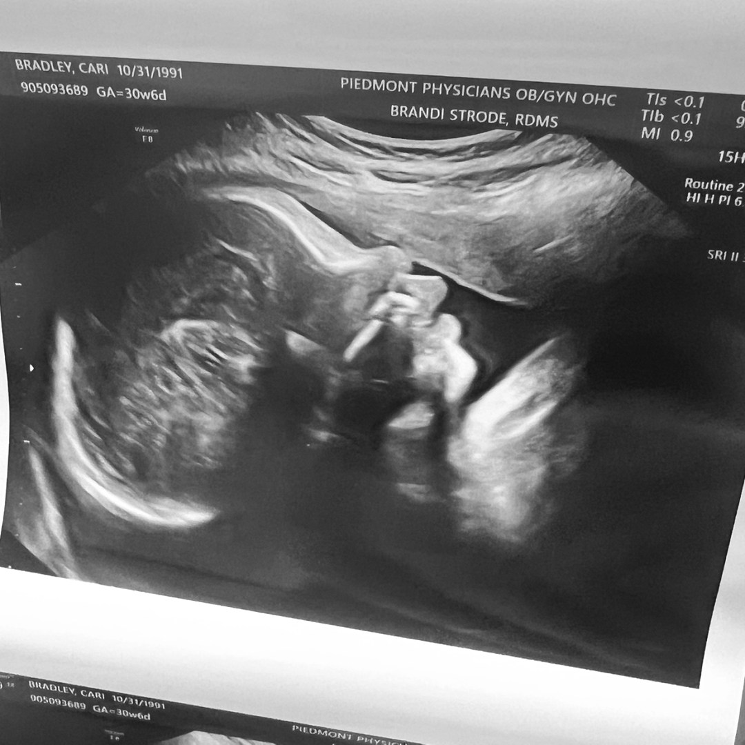 Photo shared by Cari Jess for their Babylist baby registry.