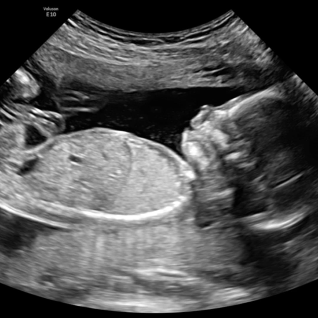 Photo shared by Alyssa for their Babylist baby registry.