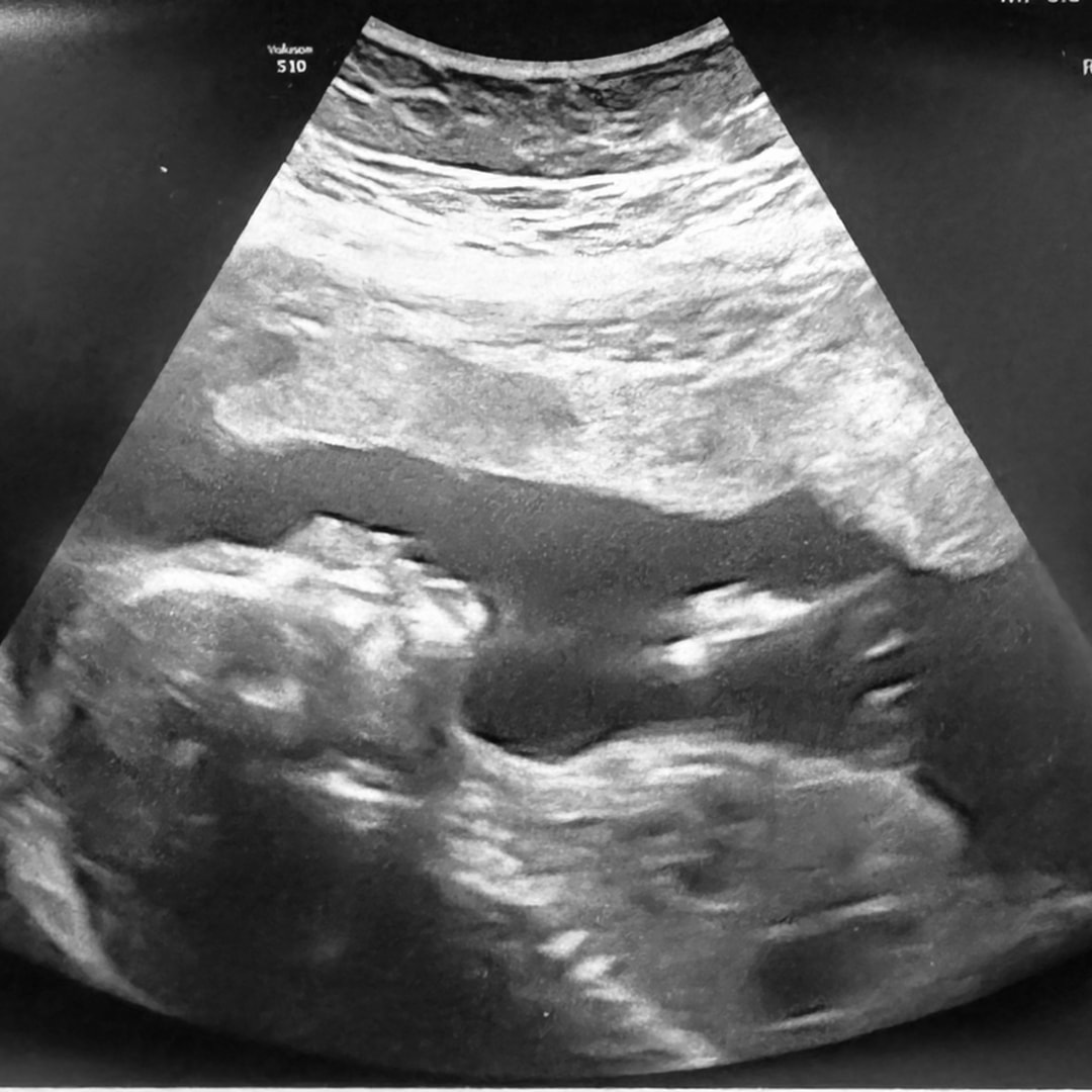 Photo shared by Michele for their Babylist baby registry.