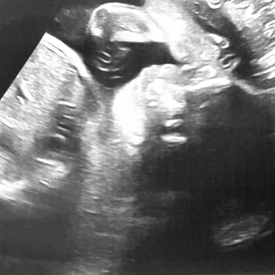 Photo shared by Abbey for their Babylist baby registry.