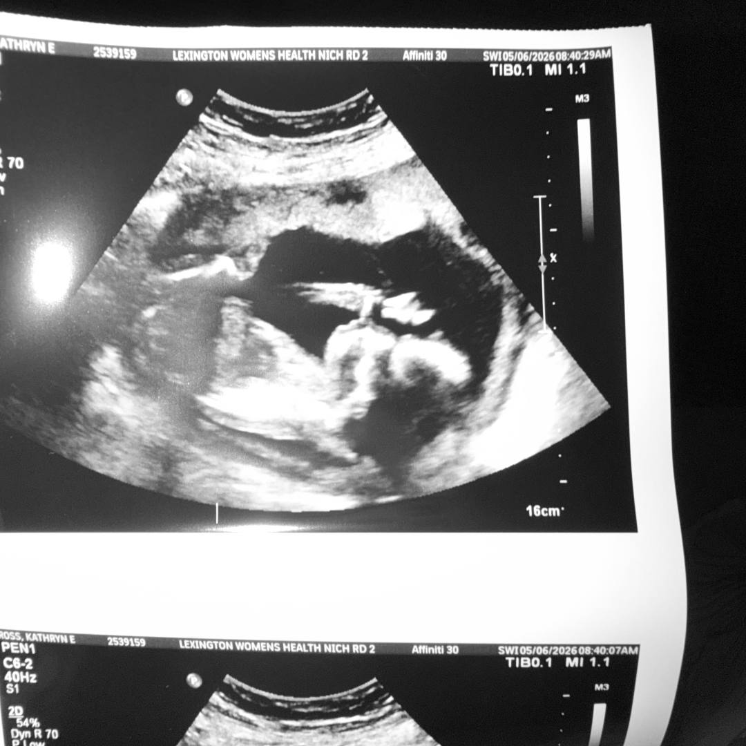 Photo shared by Kathryn for their Babylist baby registry.