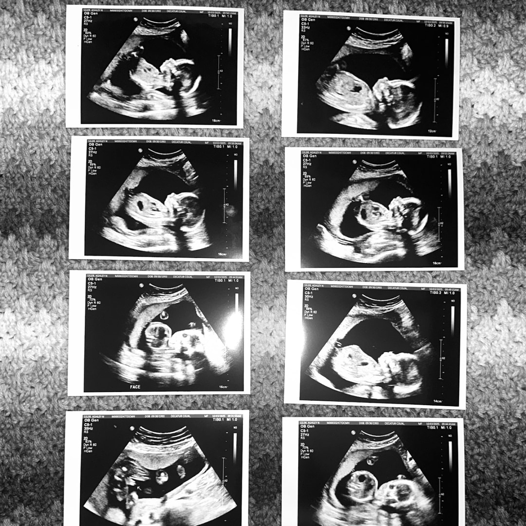 Photo shared by Ashley for their Babylist baby registry.