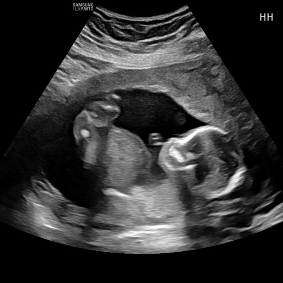 Photo shared by Deserae for their Babylist baby registry.