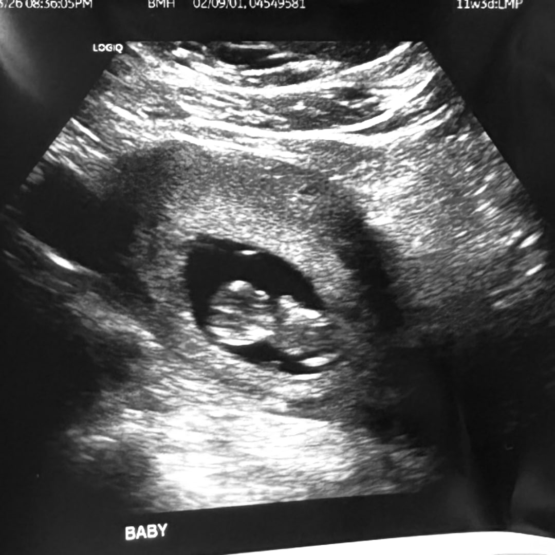 Photo shared by Keandra for their Babylist baby registry.