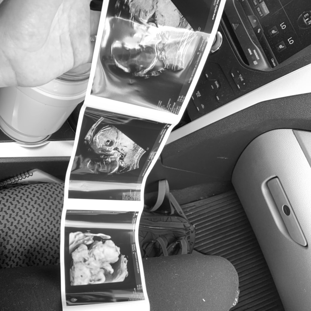 Photo shared by Kaylee for their Babylist baby registry.