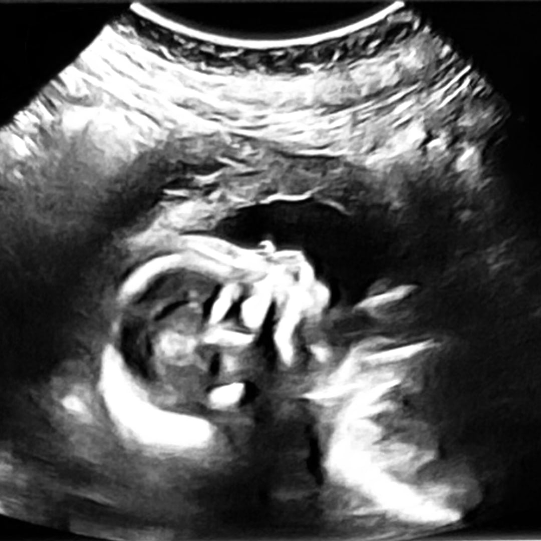 Photo shared by Angelle for their Babylist baby registry.