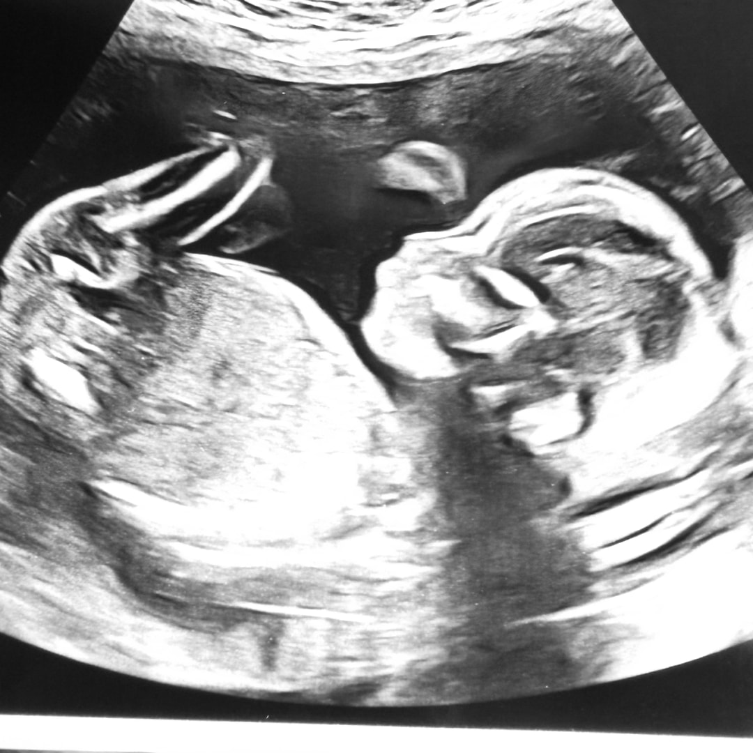 Photo shared by Shirley Ann for their Babylist baby registry.