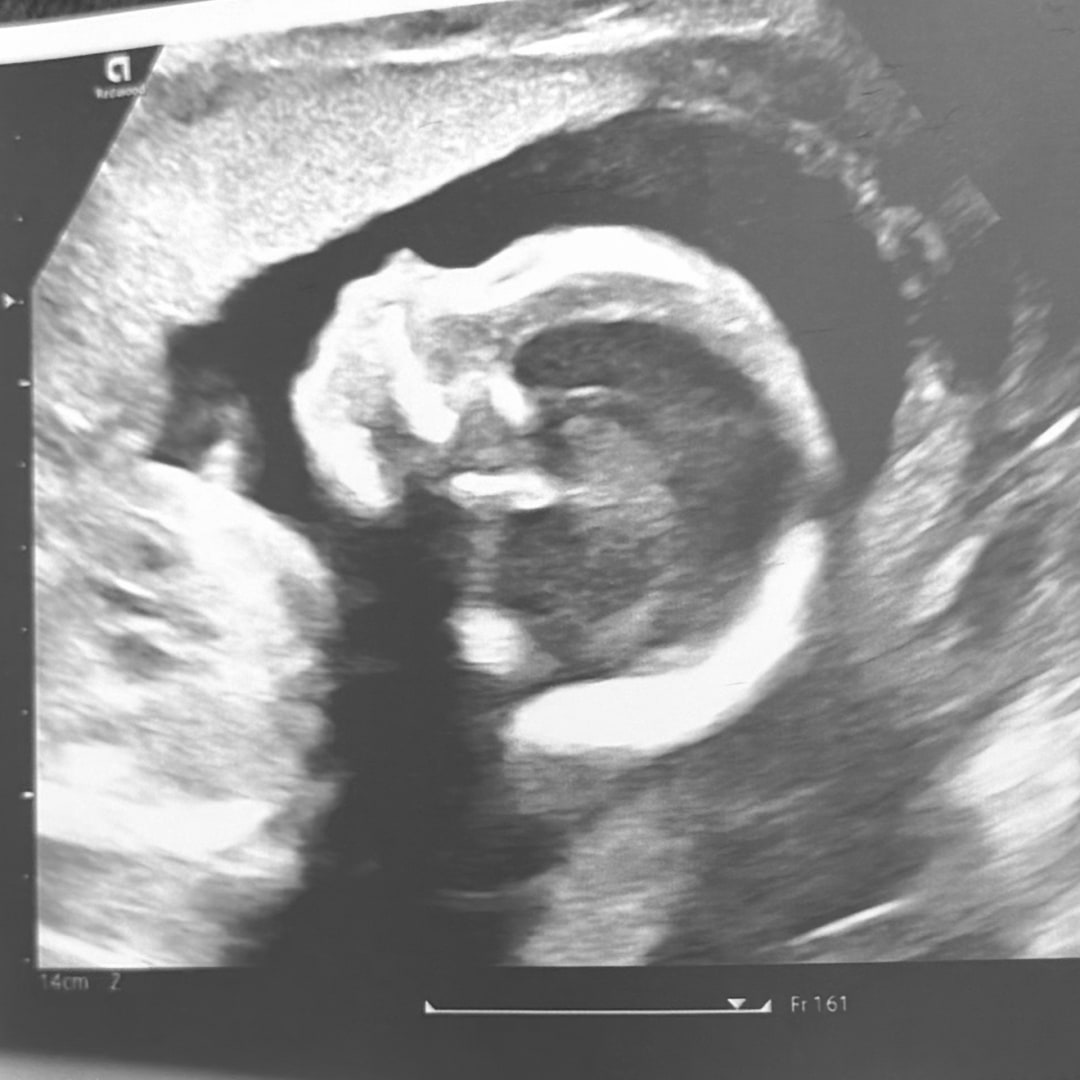Photo shared by Cayley for their Babylist baby registry.