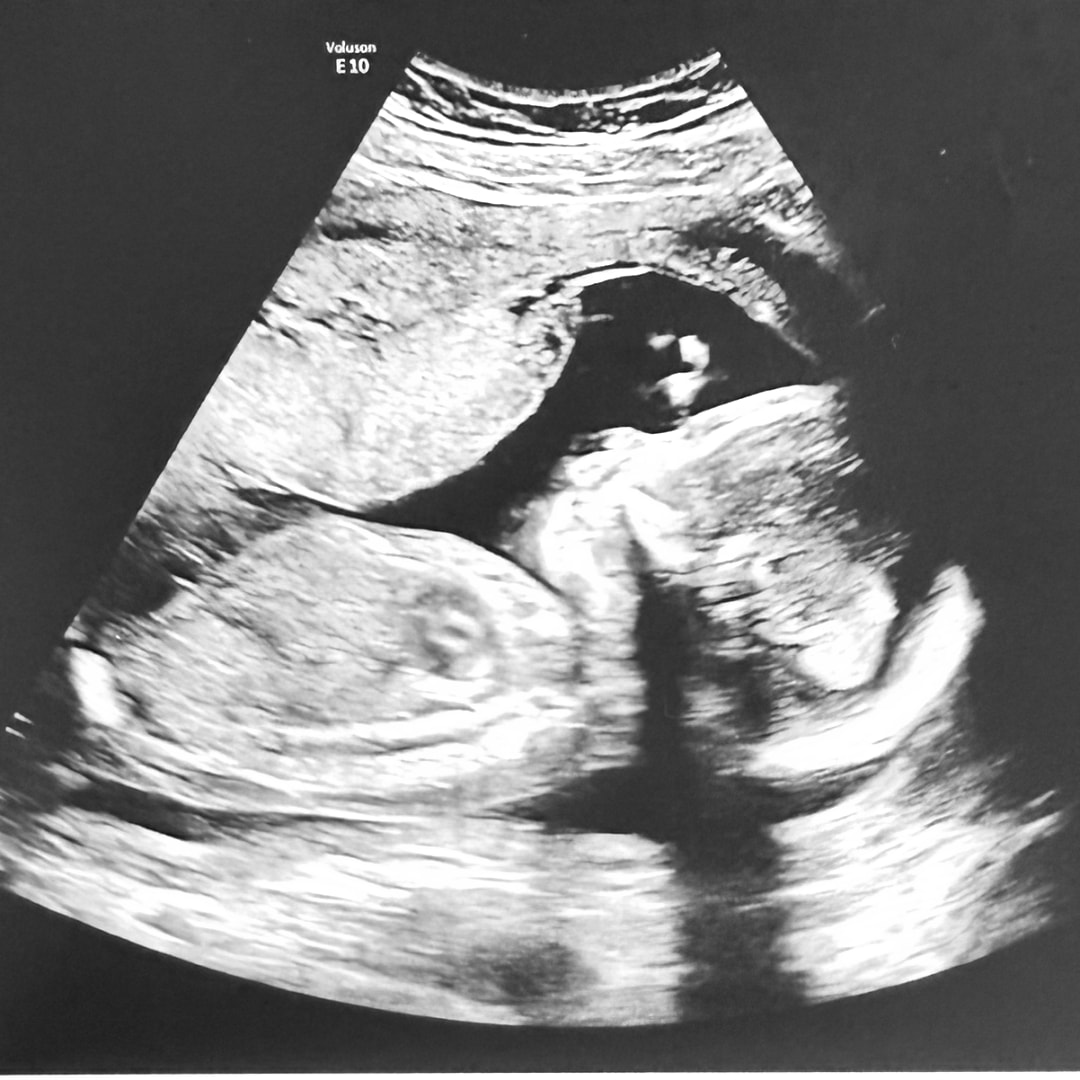 Photo shared by Angelina for their Babylist baby registry.