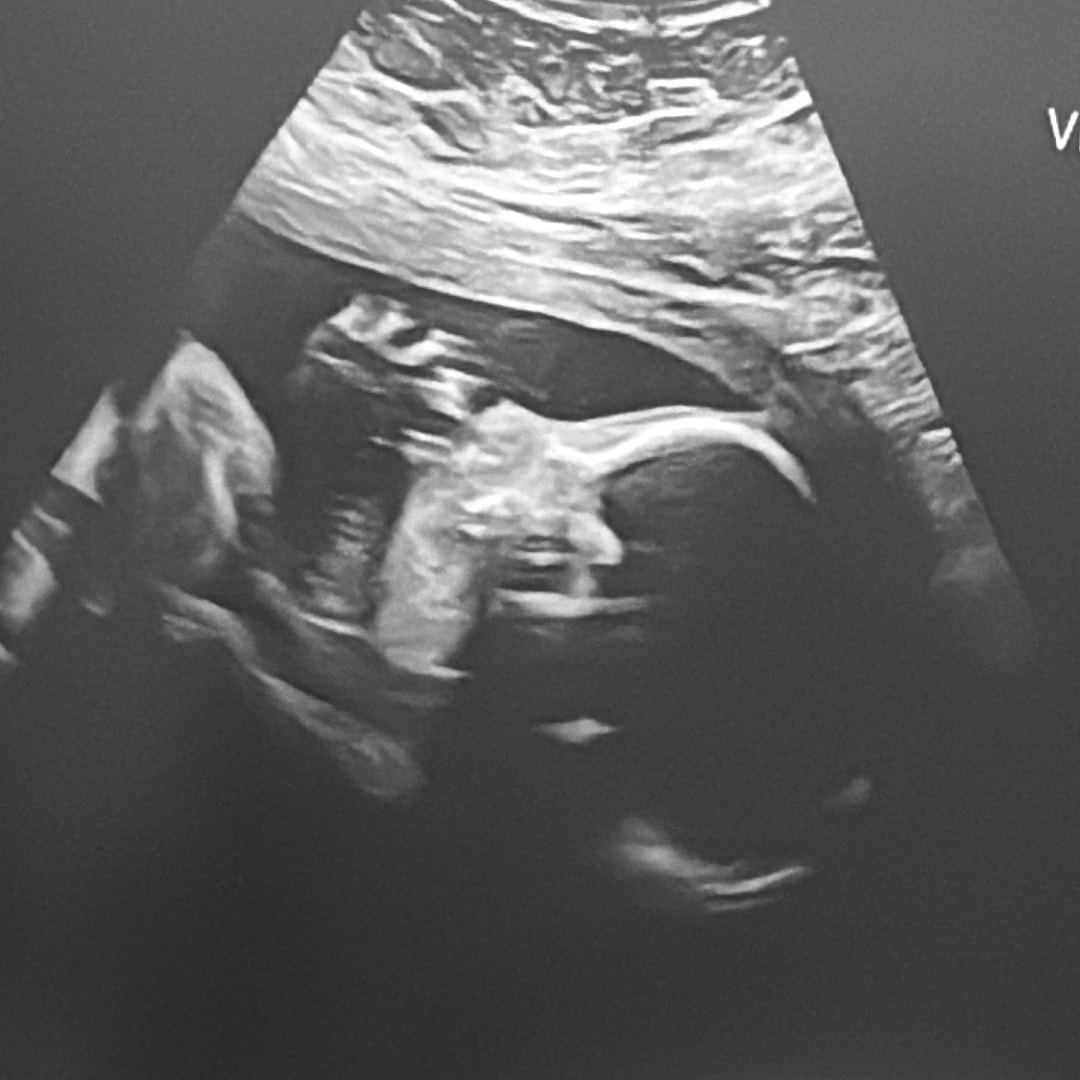 Photo shared by Beatriz for their Babylist baby registry.