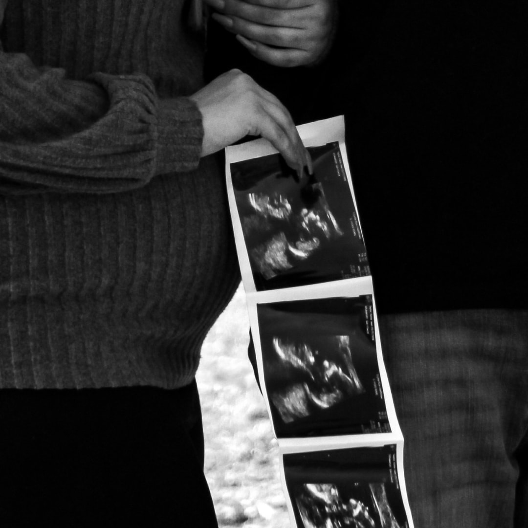 Photo shared by Katie for their Babylist baby registry.