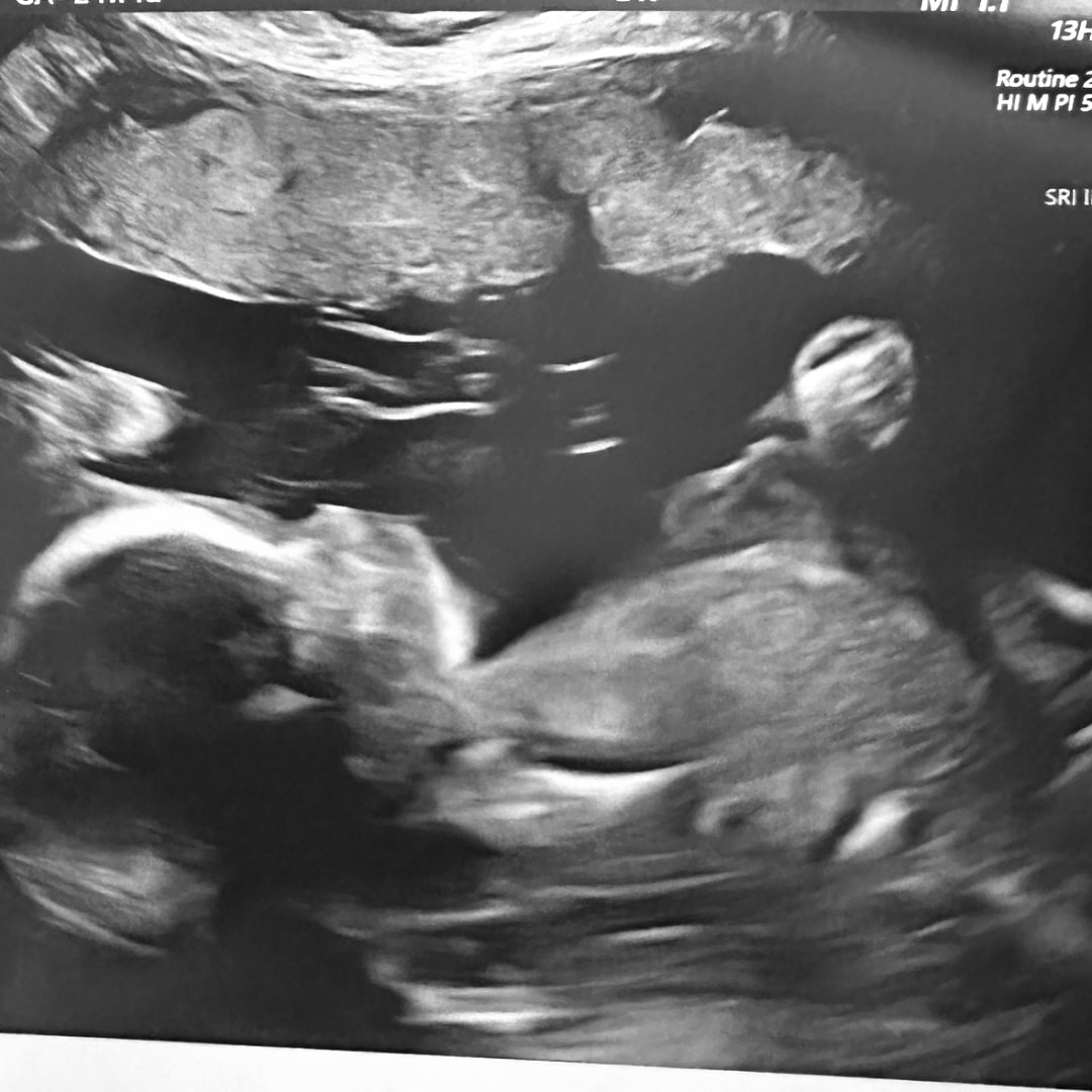 Photo shared by Cassidy for their Babylist baby registry.