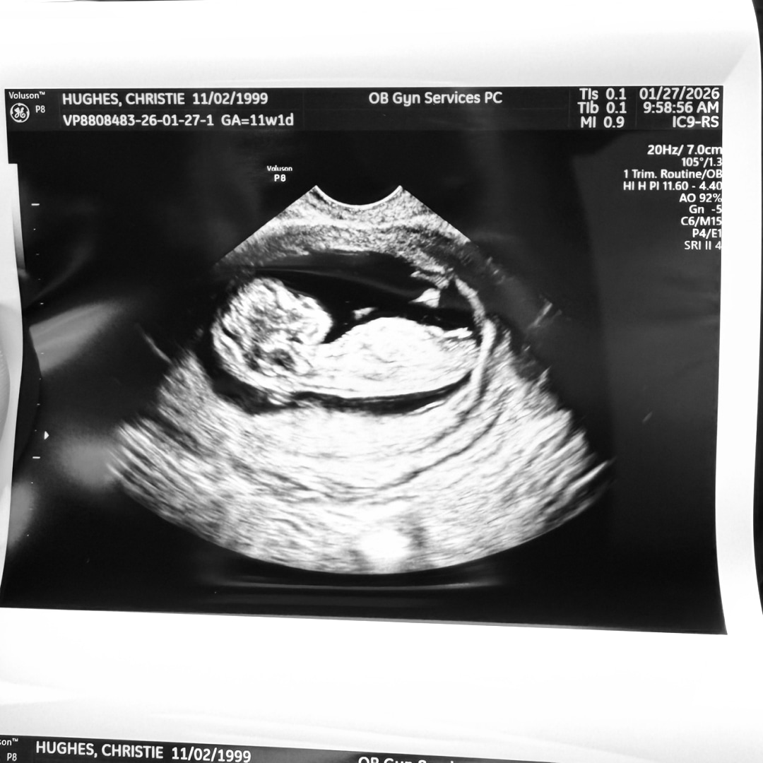 Photo shared by Christie for their Babylist baby registry.