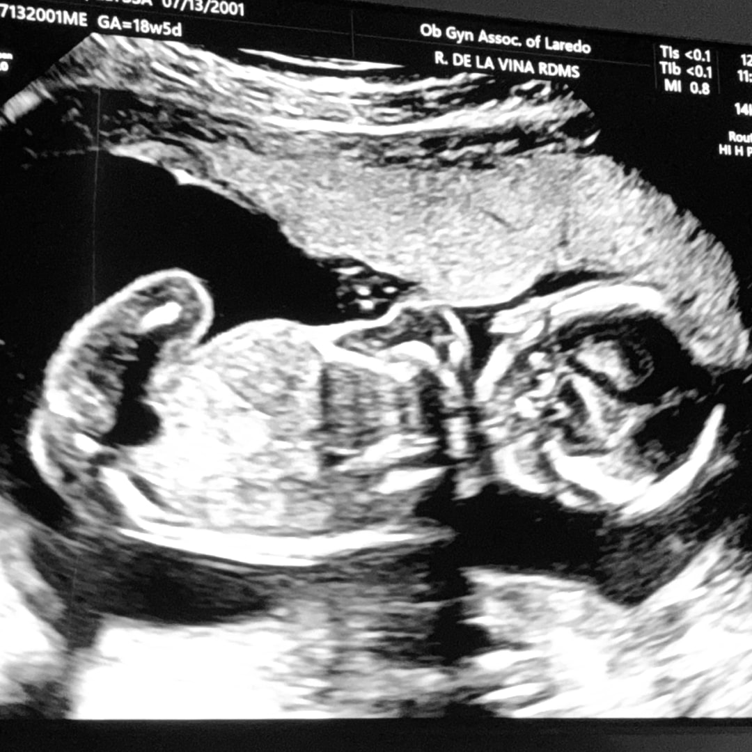 Photo shared by Ely for their Babylist baby registry.