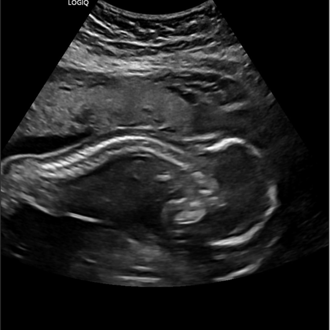 Photo shared by Hayleigh for their Babylist baby registry.