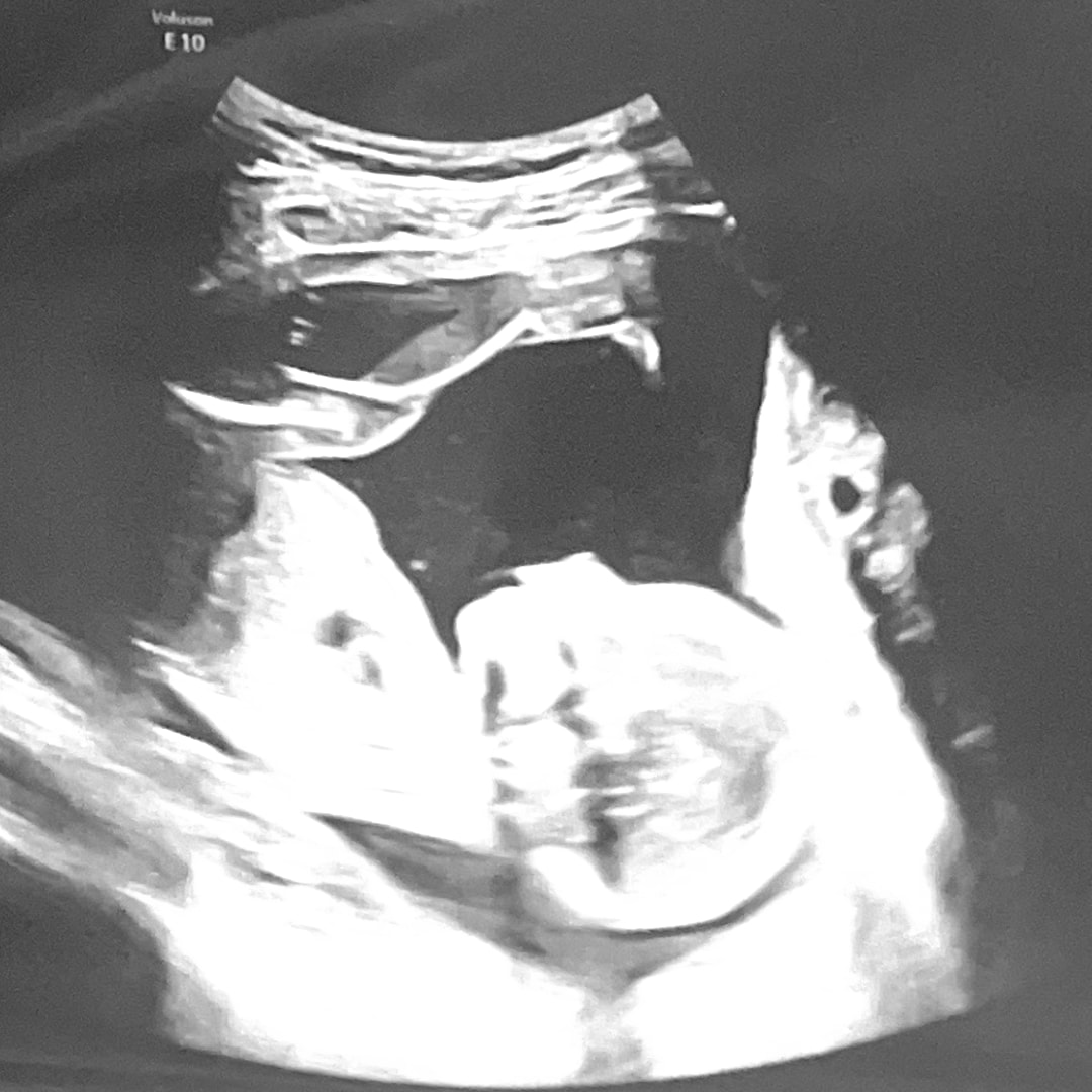 Photo shared by Corena for their Babylist baby registry.