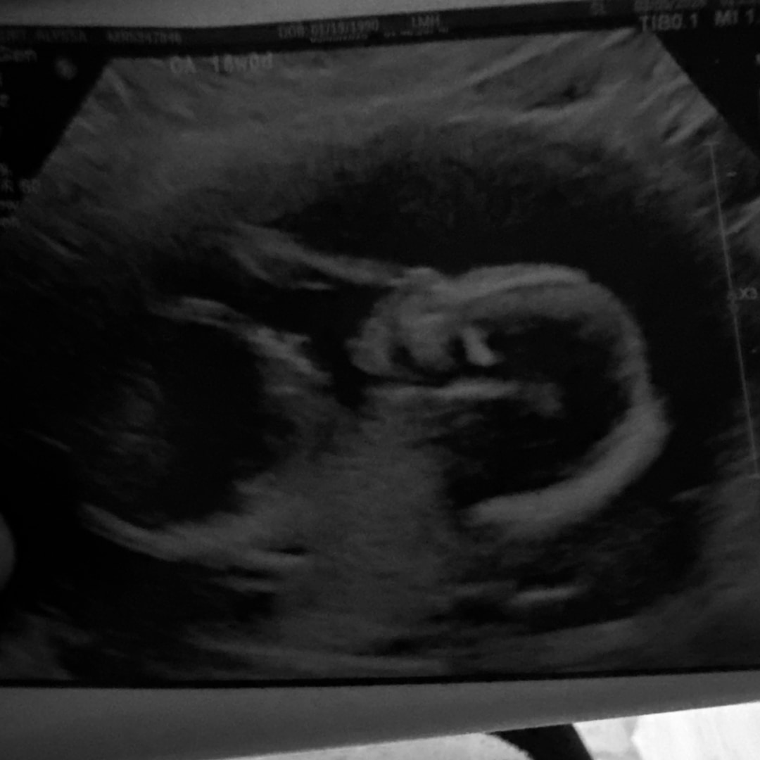 Photo shared by Alyssa for their Babylist baby registry.