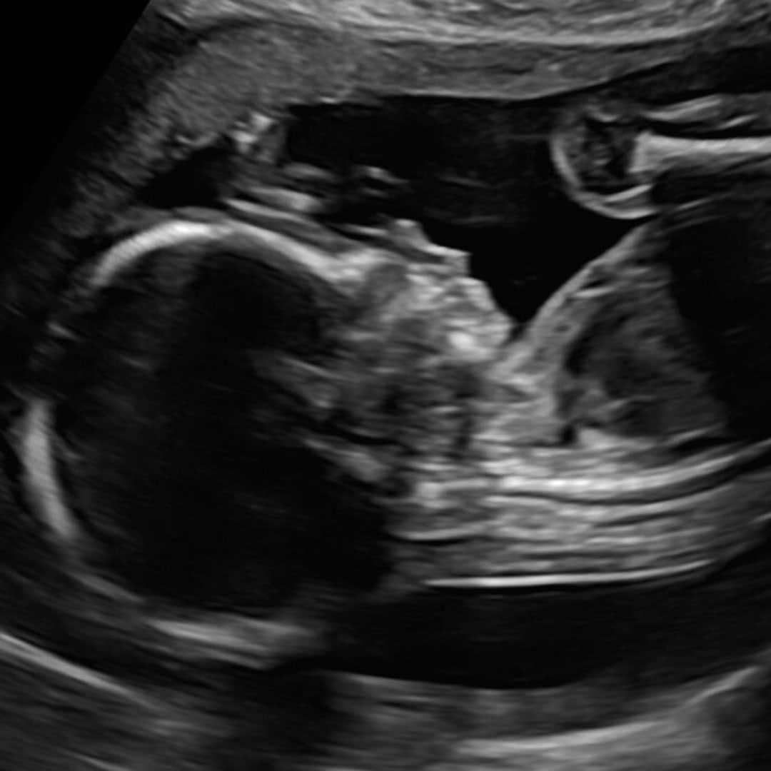 Photo shared by Sarah for their Babylist baby registry.