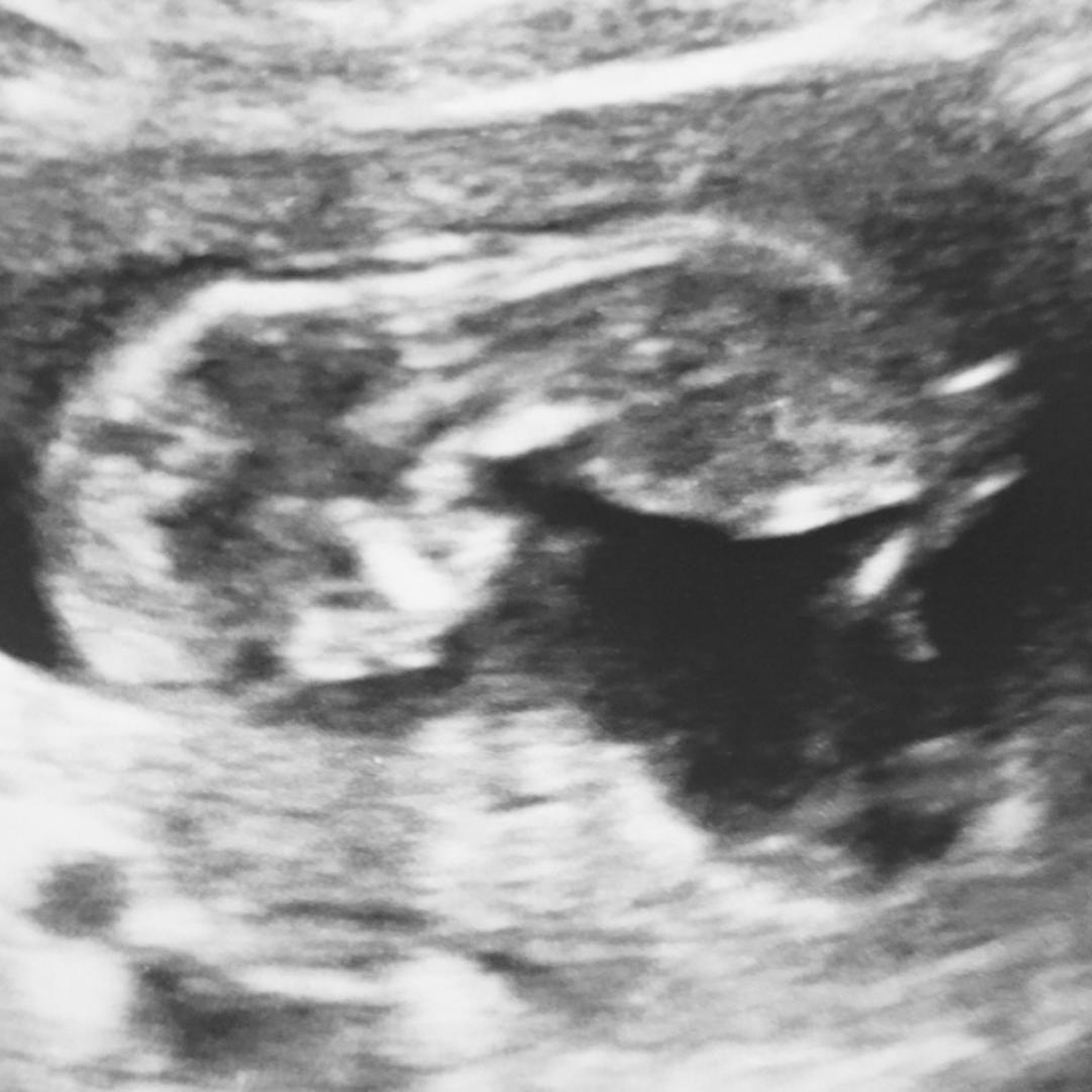 Photo shared by Shyenne for their Babylist baby registry.