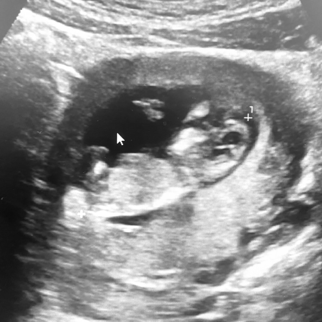 Photo shared by MyAsia for their Babylist baby registry.