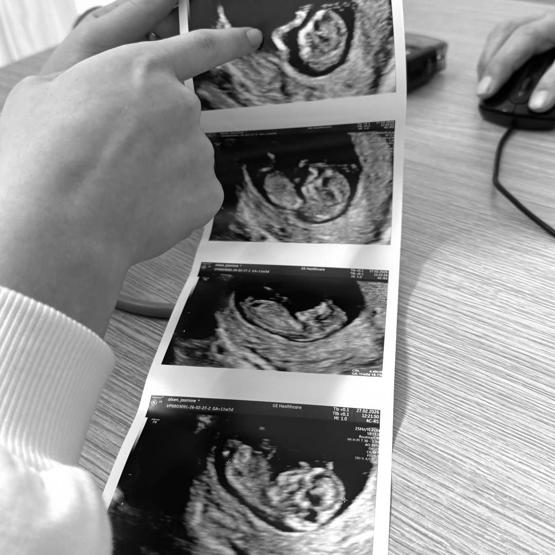 Photo shared by Azarya for their Babylist baby registry.