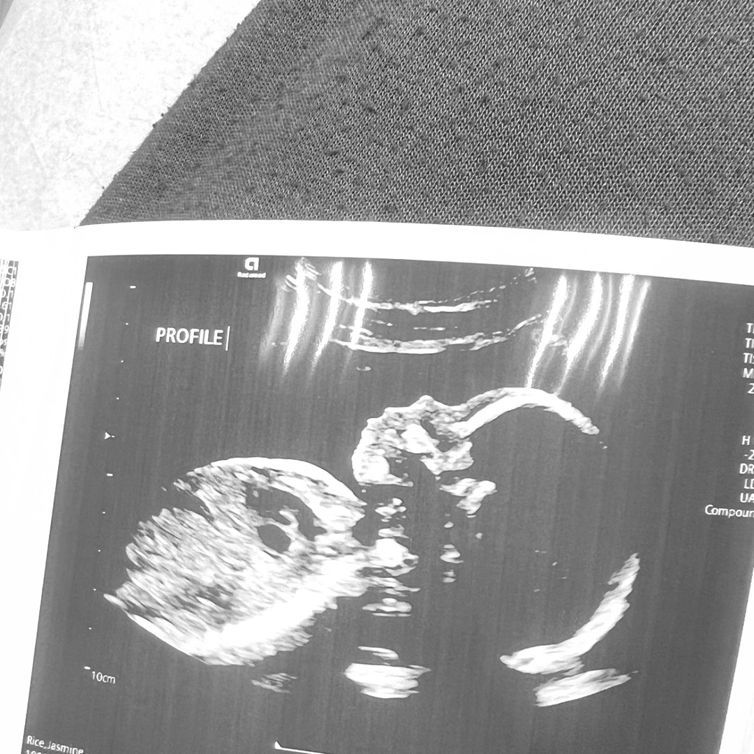 Photo shared by Jasmine for their Babylist baby registry.