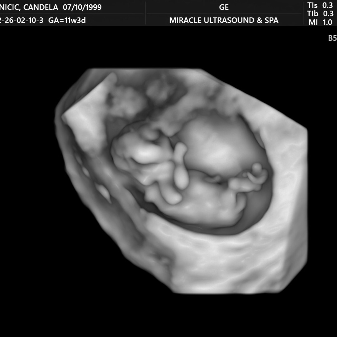 Photo shared by Candela for their Babylist baby registry.