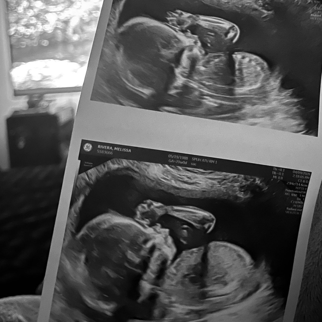 Photo shared by Melissa for their Babylist baby registry.