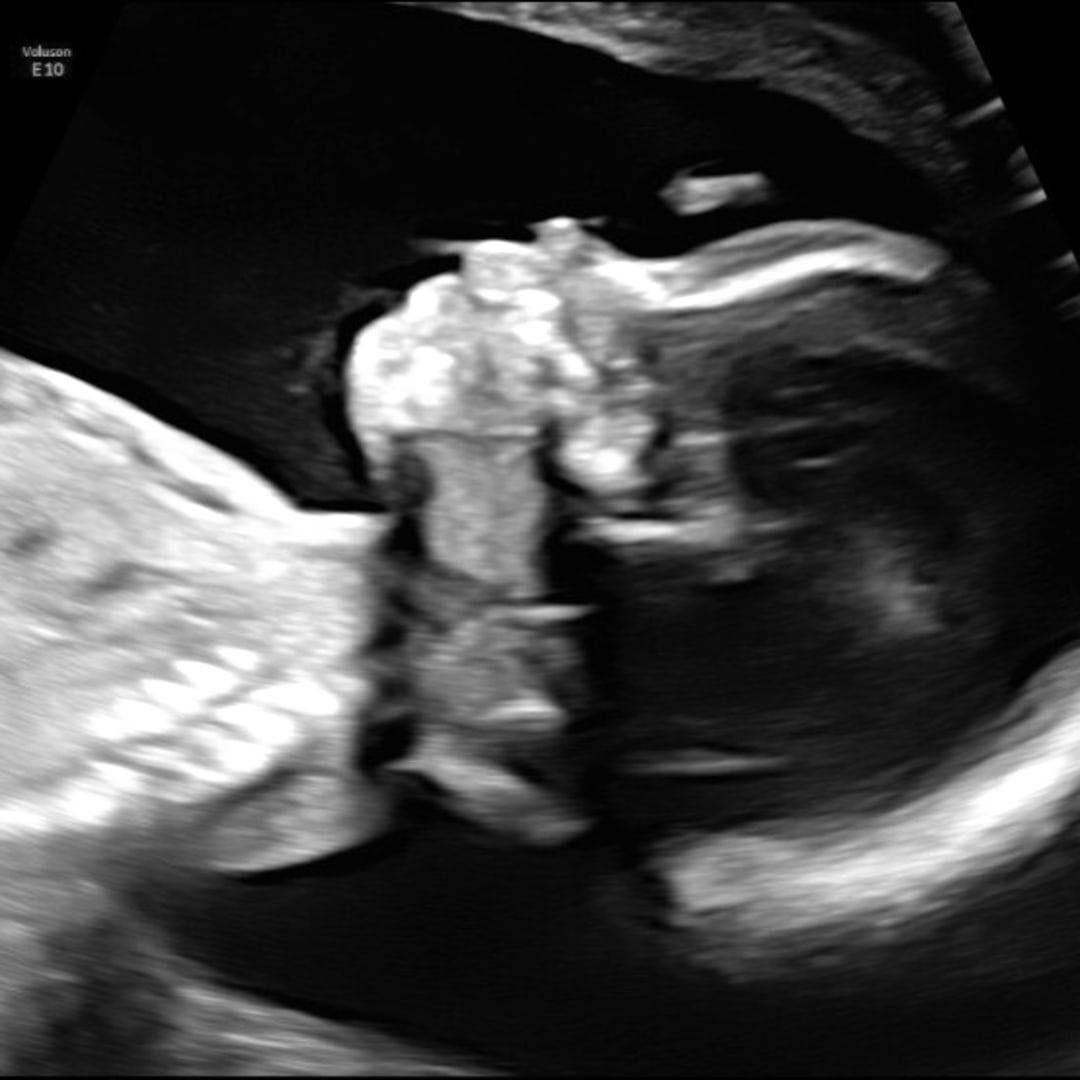 Photo shared by Claudia for their Babylist baby registry.