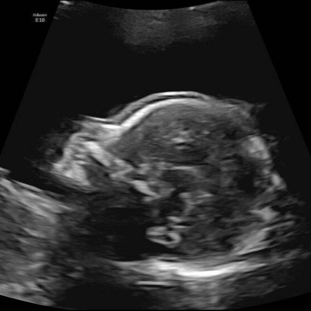 Photo shared by Brenda for their Babylist baby registry.