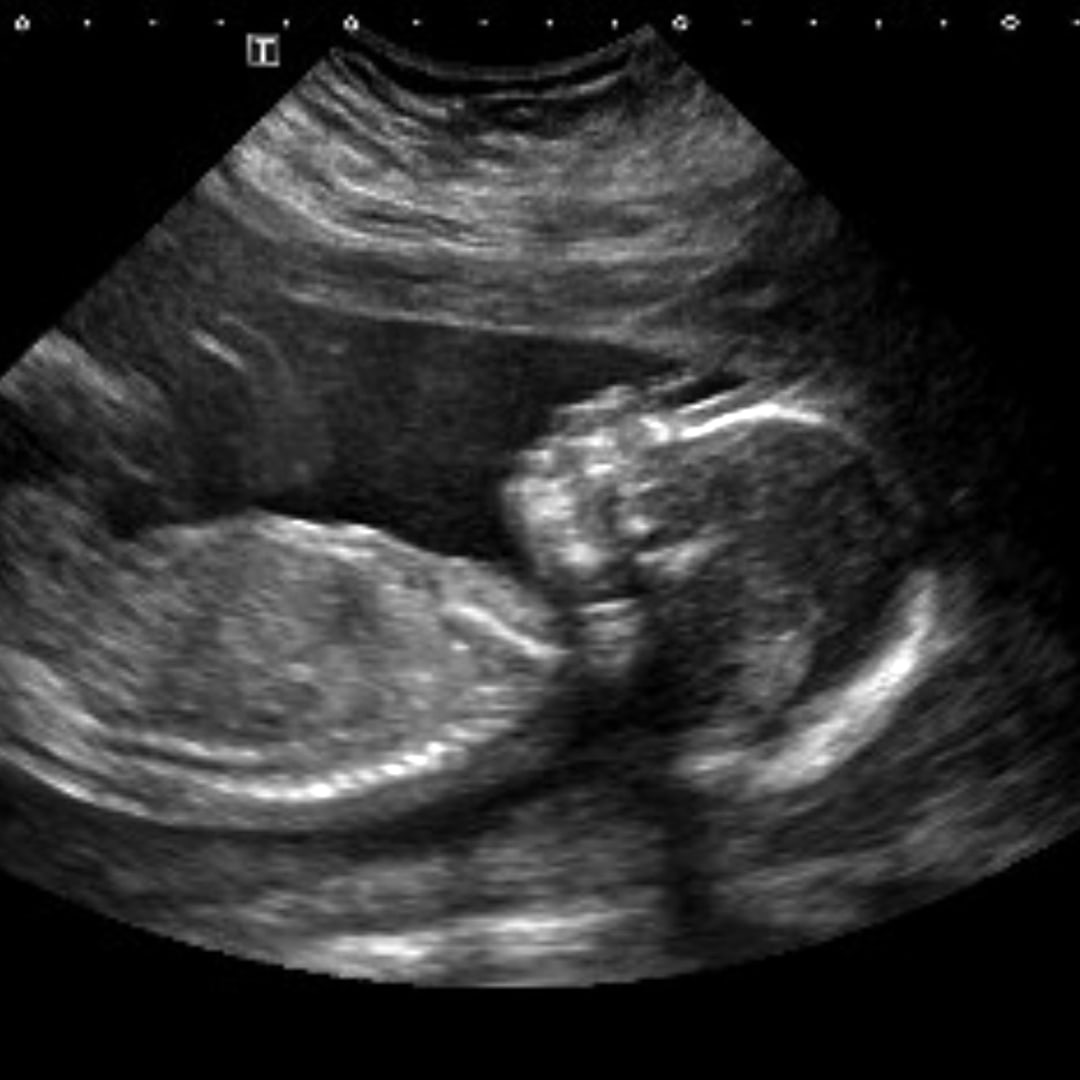 Photo shared by Ariana for their Babylist baby registry.