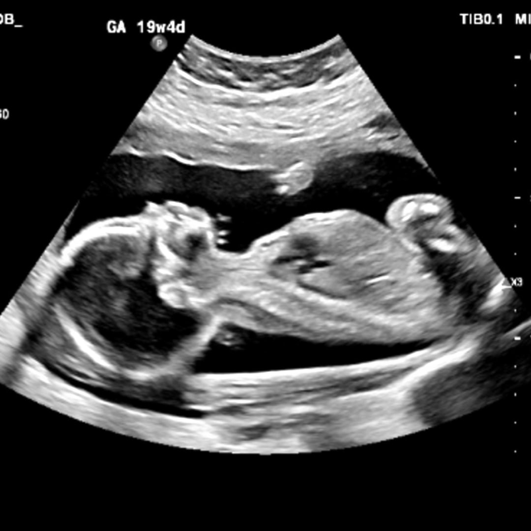 Photo shared by Shelby for their Babylist baby registry.