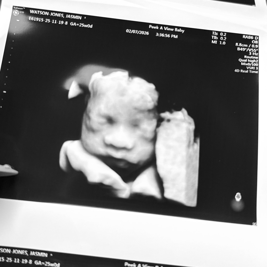 Photo shared by Jasmin for their Babylist baby registry.