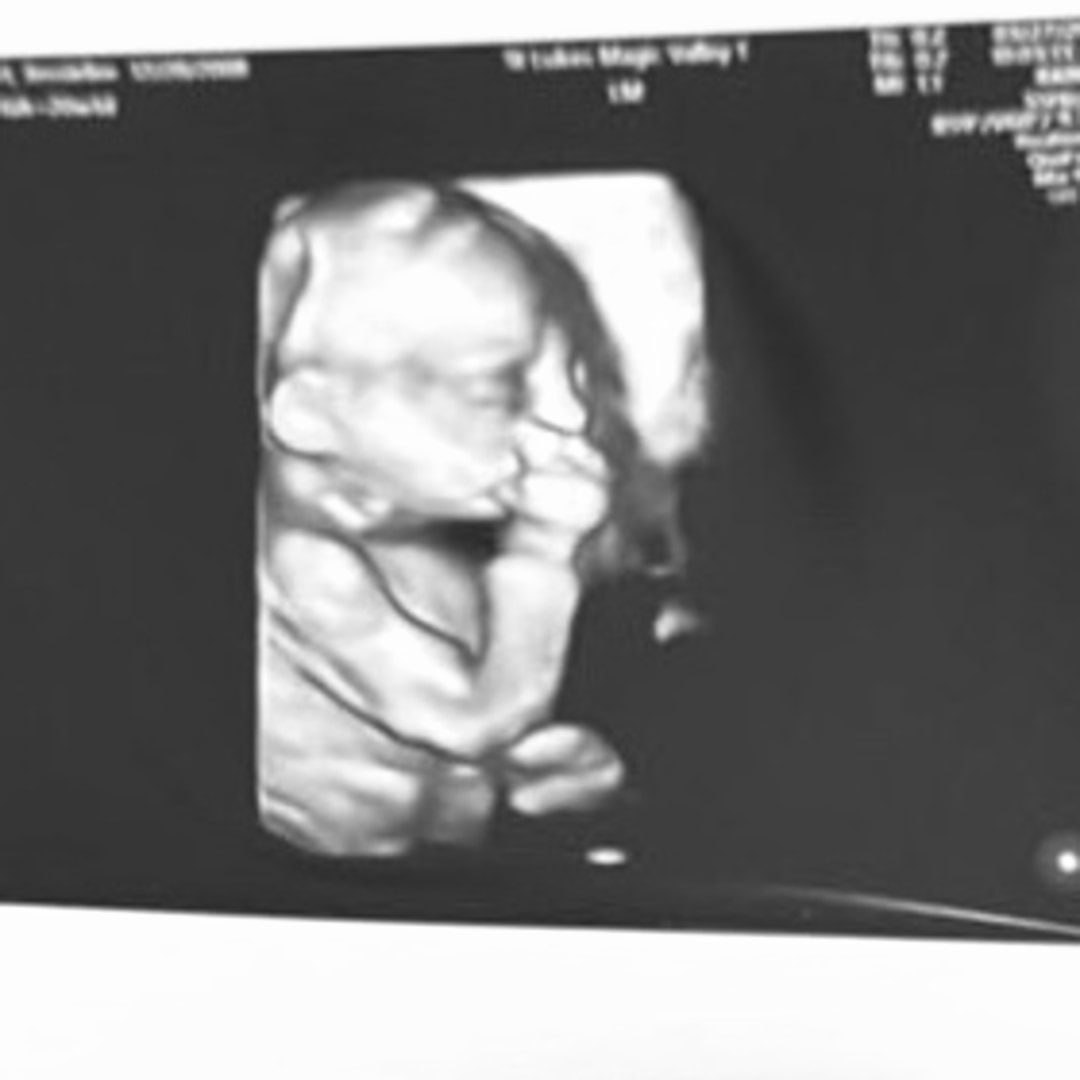 Photo shared by Jessielee for their Babylist baby registry.