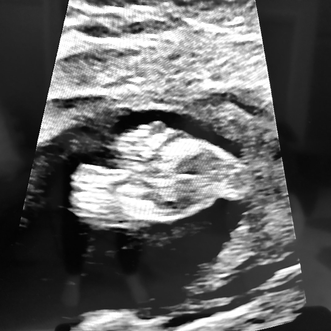 Photo shared by Jenai for their Babylist baby registry.