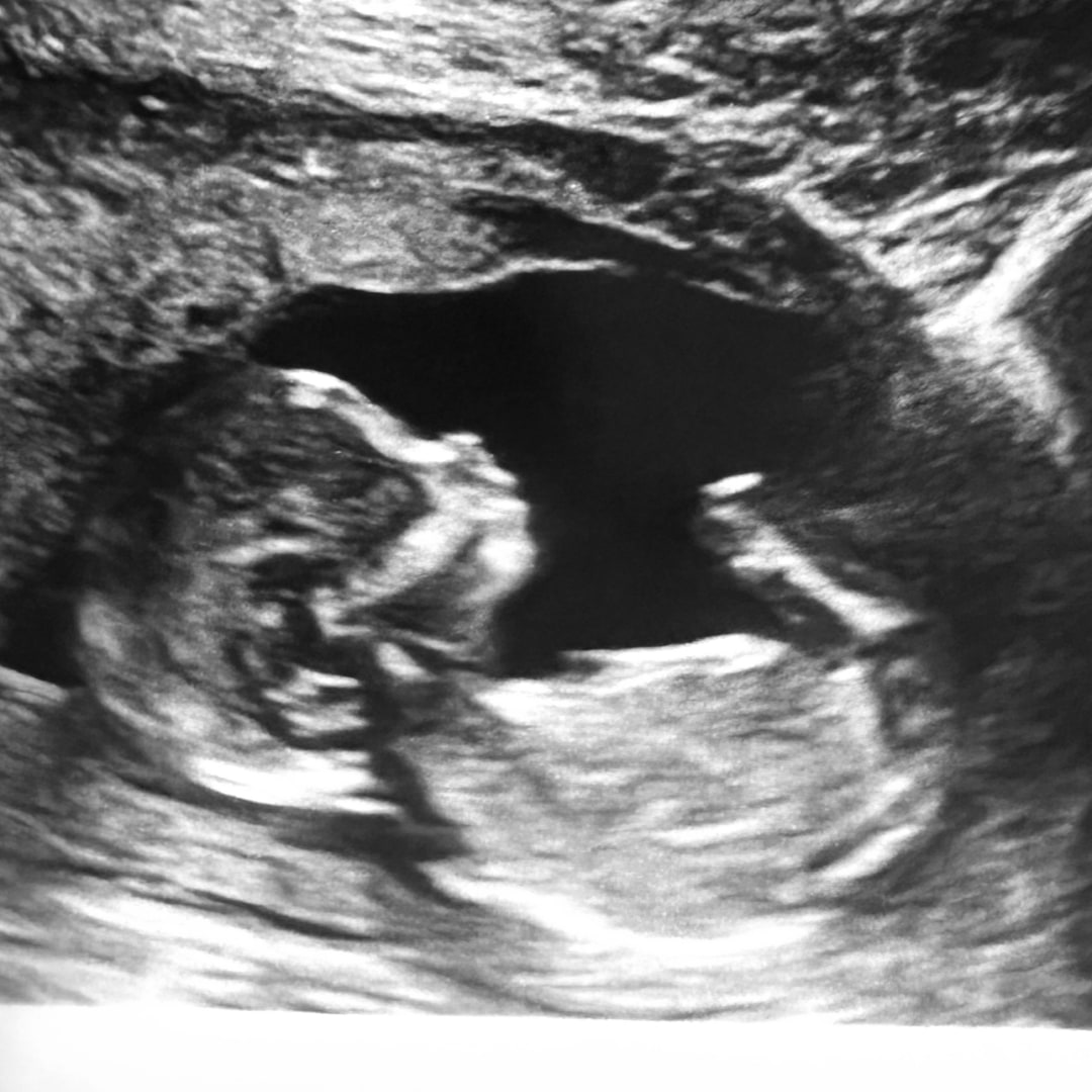 Photo shared by Shaley for their Babylist baby registry.