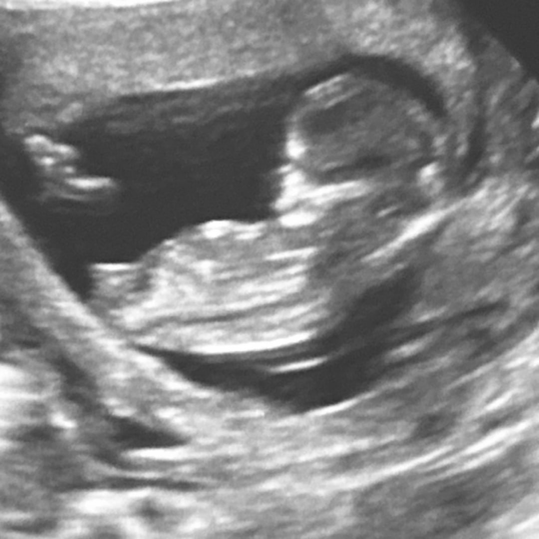 Photo shared by Tanya for their Babylist baby registry.