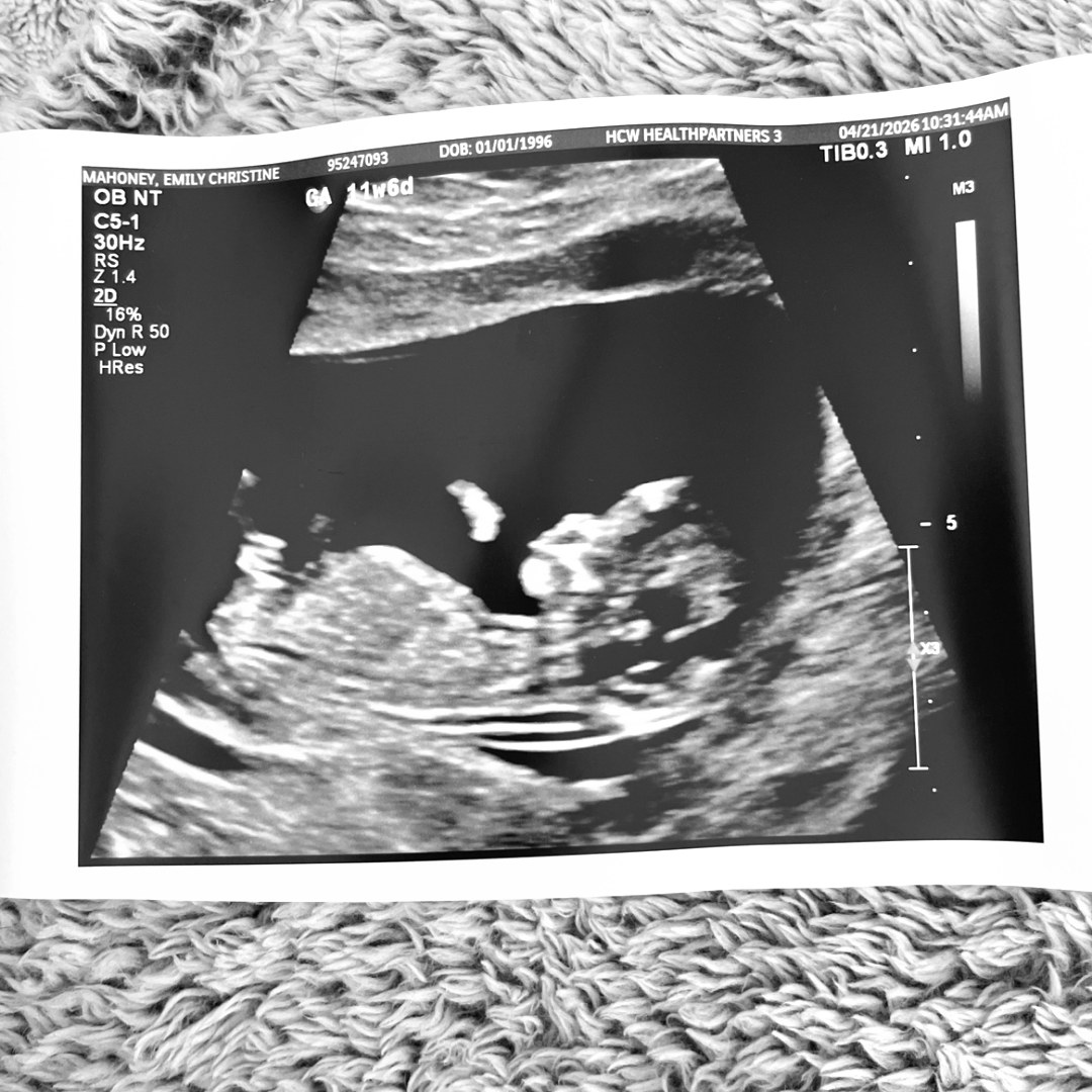 Photo shared by Emily for their Babylist baby registry.